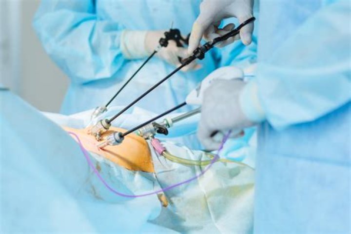 Is rectopexy major surgery?