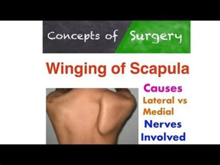 What nerve causes winged scapula?