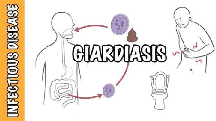 When is giardiasis serious?